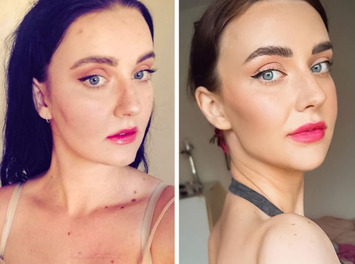 20+ Girls Who Decided to Get Plastic Surgery and Proved There Are No Limits When It Comes to Perfection