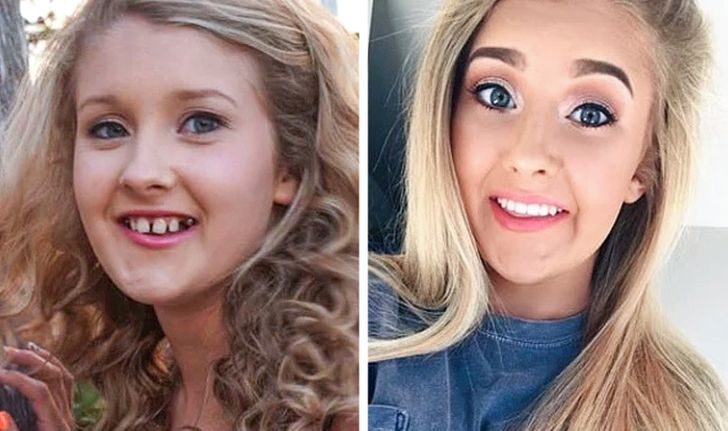 Internet Users Showed How Much Their Look Changed After They Fixed Just One Detail