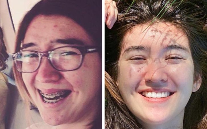 20+ People Who Know for Sure That Beauty Is a Cruel Mistress