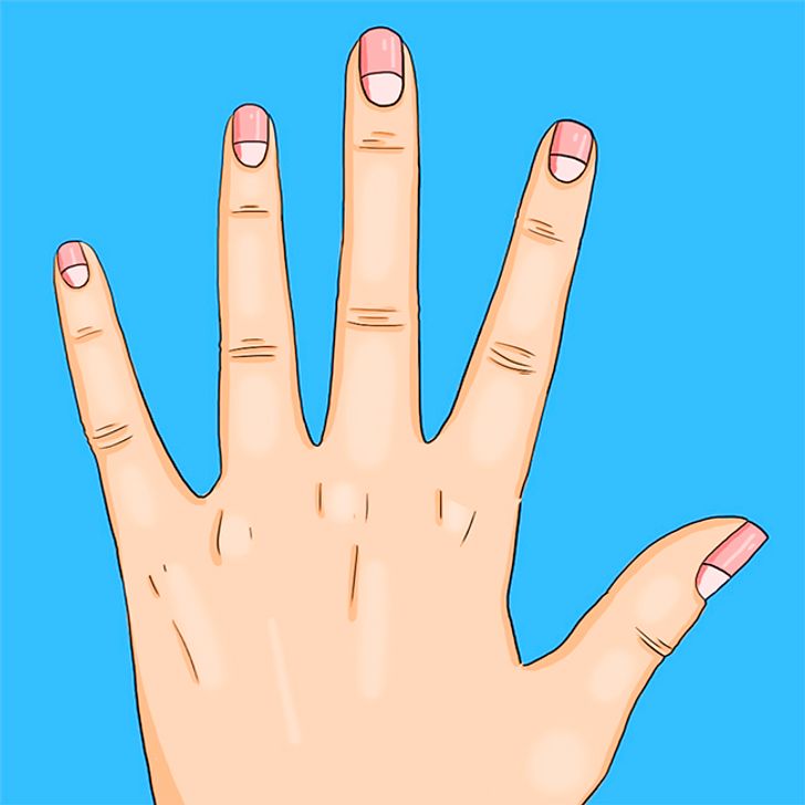 13 Health Problems the Moons on Your Nails Warn You About