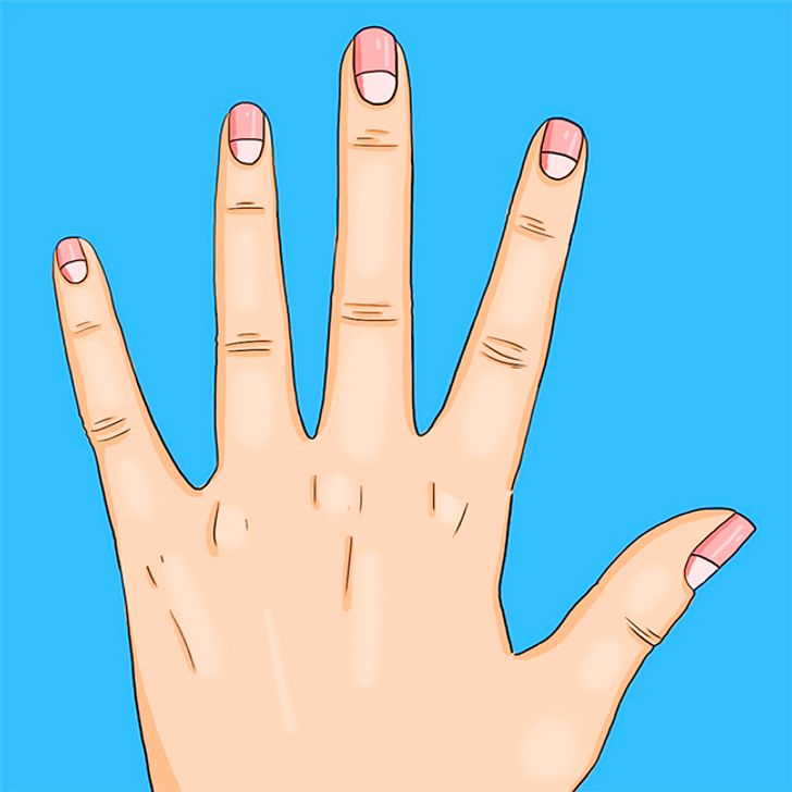 13 Health Problems The Moons On Your Nails Warn You About Bright Side