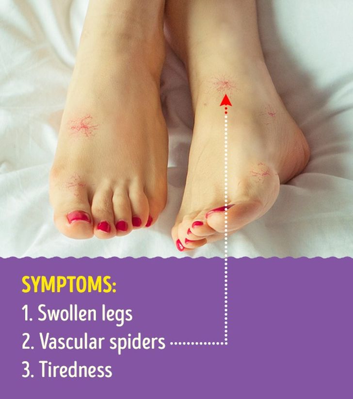 9 Leg Health Problems That Can Signal Serious Illnesses