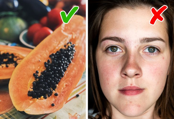 Foods That Will Reduce Acne Scars PsychologyTodayArticles