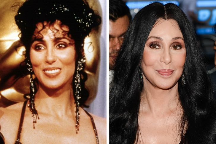 16 Celebrities Who Regretted Their Cosmetic Procedures