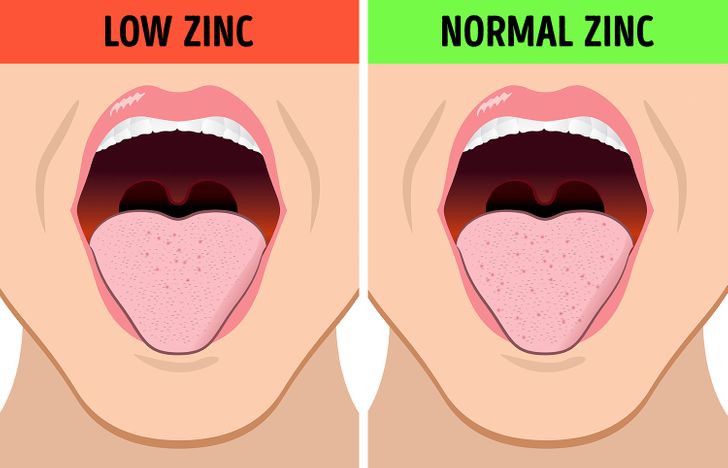 metallic-taste-in-your-mouth-metal-taste-andrew-weil-m-d