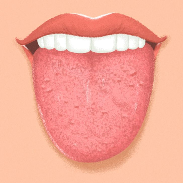 9 Things Your Tongue Is Trying to Tell You About Your Health