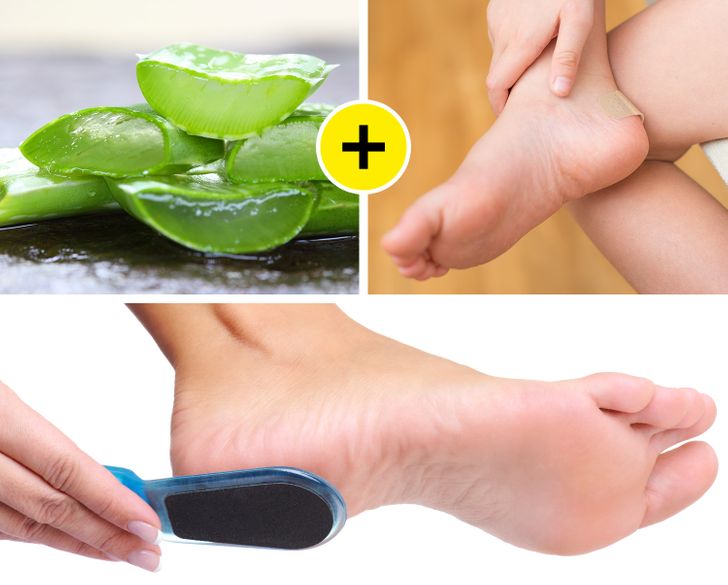 Best Fix For Calluses - How I Fixed My Dry Feet — First Thyme Mom