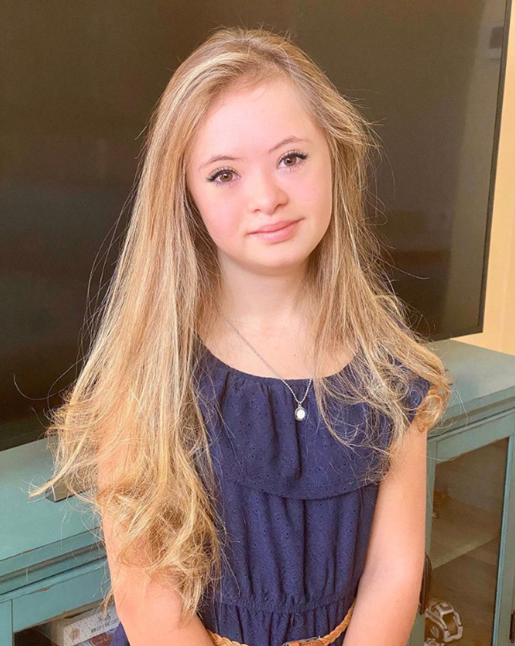 A Girl With Down Syndrome Beats Doctors Odds And Grows Into A Stunningly Beautiful Model 