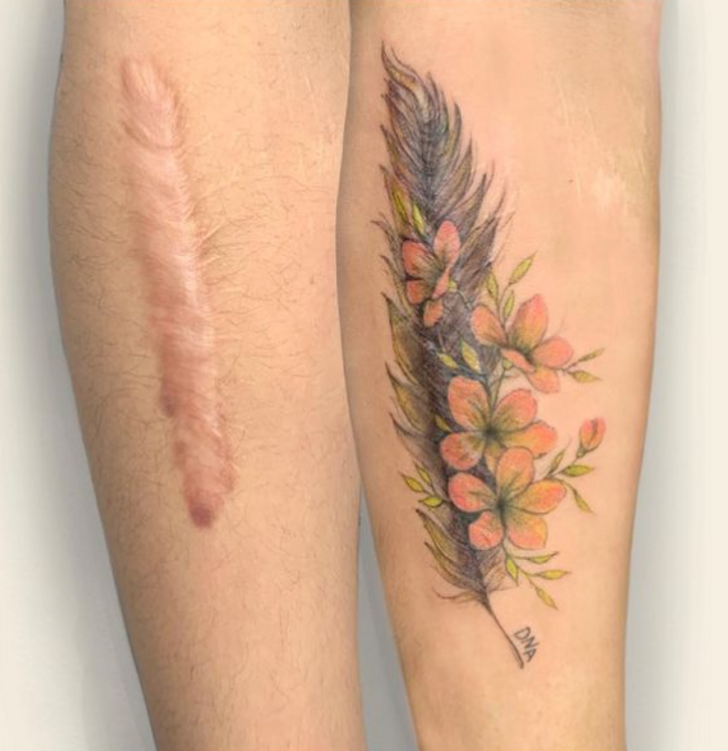 A Vietnamese Artist Uses Her Magical Touch to Help People Regain Self-Confidence by Covering Their Scars With Art