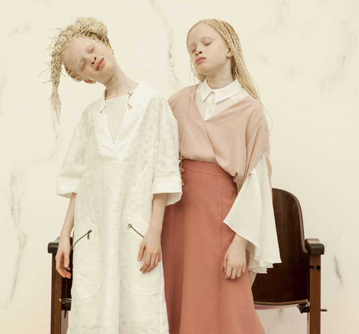 The Utterly Unique Appearance of These Twins Has Stunned the Internet