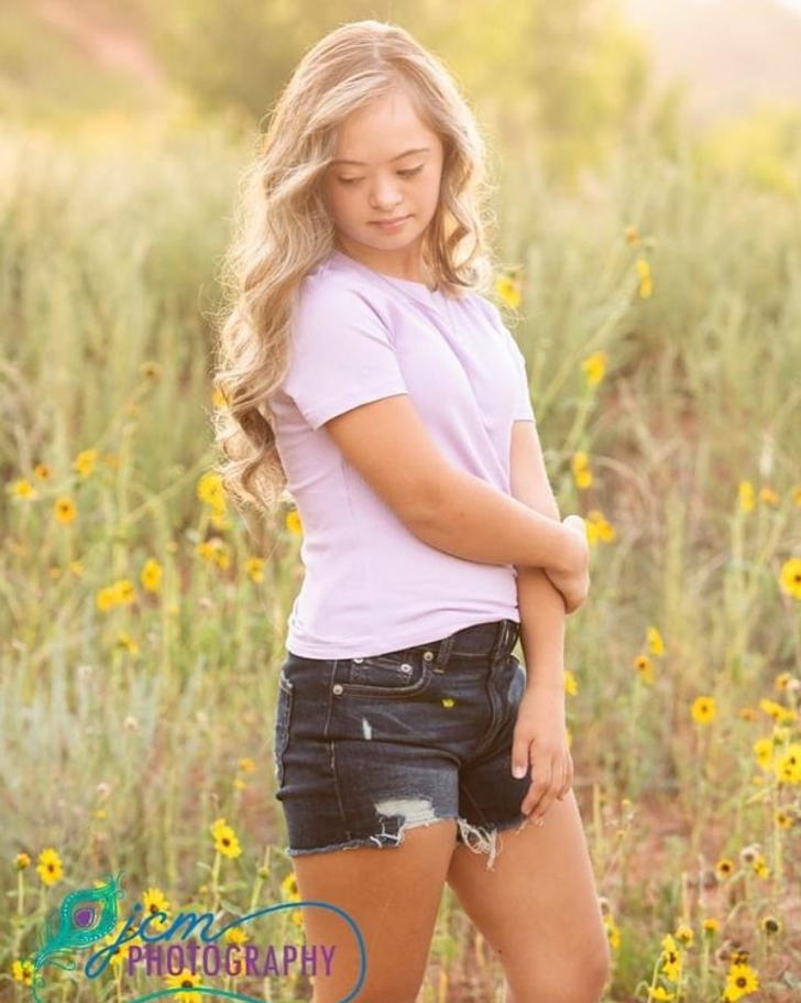 A Girl With Down Syndrome Beats Doctor’s Odds and Grows Into a Stunningly Beautiful Model