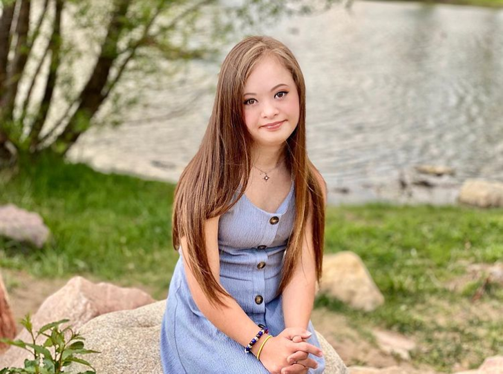 A Girl With Down Syndrome Beats Doctor’s Odds and Grows Into a Stunningly Beautiful Model