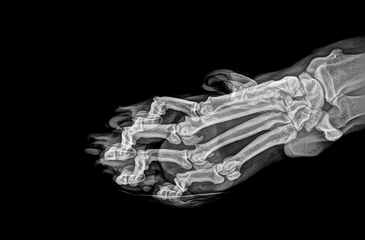 14 röntgenových lúčov, ktoré ukazujú skryté časti nášho života