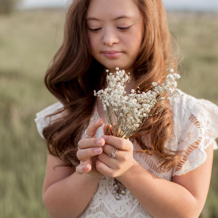 A Girl With Down Syndrome Beats Doctor’s Odds and Grows Into a Stunningly Beautiful Model