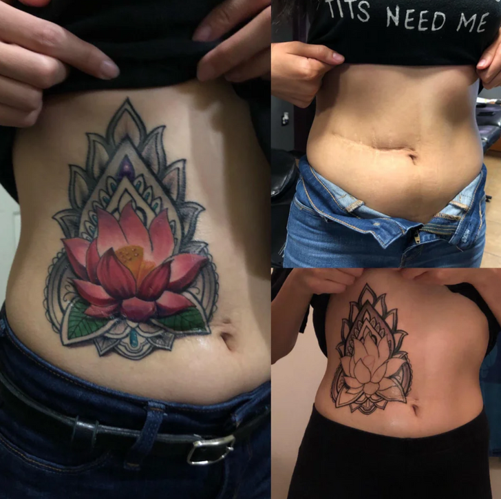 This tattoo artist helps women cover their scars with beautiful art