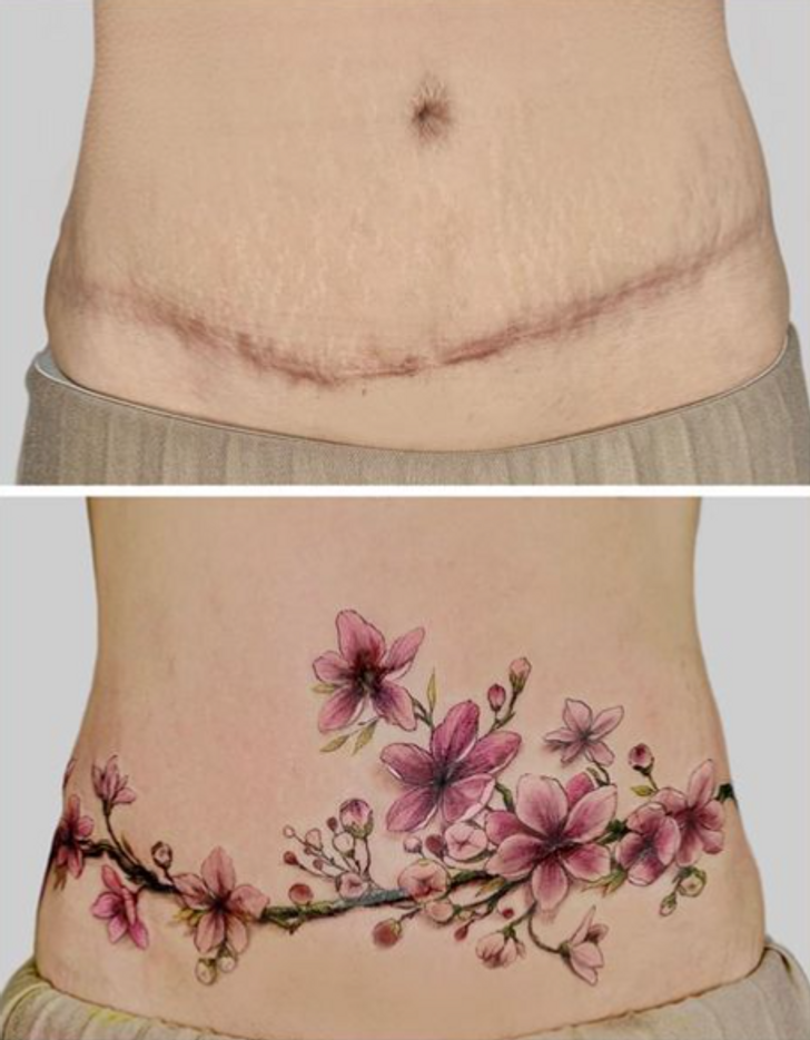 50 Amazing Scar CoverUp Tattoos  DeMilked